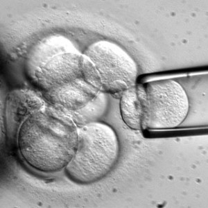 celulas-madre-embrionarias-300Ã—300.jpg
