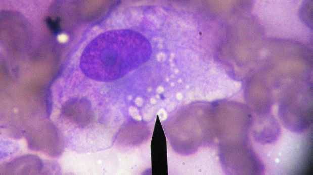 microchip separa células cancerosas