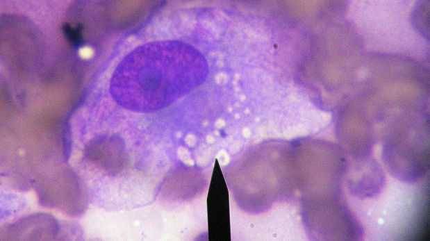 microchip separa por sonido células cancerosas-sound microchip separated by cancer cells microchip separa células cancerosas
